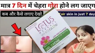 Lotus herbals whiteglow with Niacinamide Gel Cream Honest review | Lotus herbals | Lotus Cream |skin