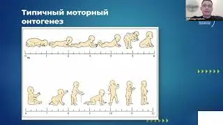 Нетипичный моторный онтогенез