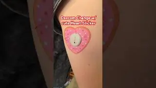Dexcom Change w/ cute Heart Sticker #diabetes #t1d #type1diabetes #dexcom #dexcomg7 #dexcomchange
