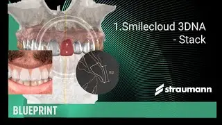 Smilecloud 3DNA - Stack