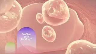 FemVue with FemCath Animation