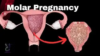 6 More Weird Pregnancies that Actually Happen