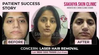 Smoother Skin with Laser Hair Removal | Real Patient Experience | Sakhiya Skin Clinic