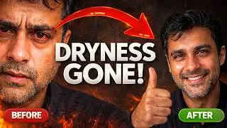 Dry Eyes Treatment | Treatment of dry eyes | Dr. Bhanu Pangtey