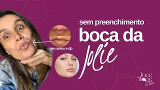 Tua boca afinou? Como fazer preenchimento labial de uma maneira totalmente natural! 👄 