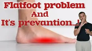 Flatfoot problem and its prevention. &bull;|&bull;hit till hurt &bull;|&bull;