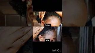Unbelievable Results this Hair Secrets Works! 😲 | hair growth tips #ytshorts #shorts  #hairgrowth
