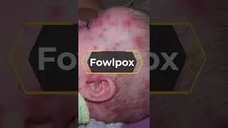 Top 7 Most Common PEACOCK DISEASES | Prevention Methods | M & A - The Animal Empire | Animal Videos