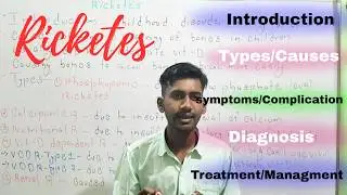 Rickets | Introduction | Cause | Symptoms | Complication | Diagnosis | Management |
