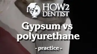 How to choose material for the model? / How to Dentist