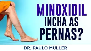 Minoxidil Oral Causa Inchaço nas Pernas? – Dr. Paulo Müller Dermatologista.