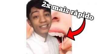 Fazer isso vai ACELERAR SEU TRATAMENTO ortod&ocirc;ntico