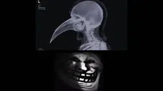 SCP-049