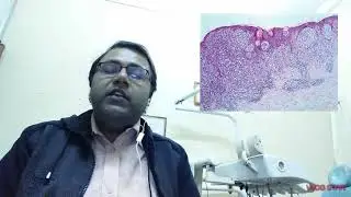 NEET MDS 2021 IMAGE BASED QUESTIONS Discussion