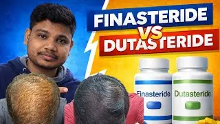 Difference Between FINASTERIDE And DUTASTERIDE Explained By SONU SAHU 