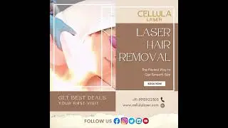 𝐋𝐚𝐬𝐞𝐫 𝐇𝐚𝐢𝐫 𝐑𝐞𝐦𝐨𝐯𝐚𝐥 The Fastest Way To Get Smooth Skin  #laserhair #hairremoval #hairremovalexpert