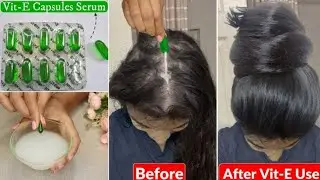 Evion 400 Vitamin E Capsules for Hair | How Use Vitamin E Capsules for hair Growth & Hair fall?