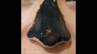 Shills Black Mask Purifying Peel-off Mask - Mod hudorme, bumser, uren hud