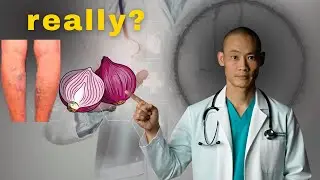 Incredible! 🤩 It's a varicose vein killer! Erases varicose veins like an eraser! The 3 best l sh..