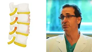 What is Spinal Stenosis and Spondylolisthesis | Neurosergeons Explained