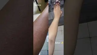 How I detan my arms using one product! #skincare #detan #tanfreeskin #tanremoval