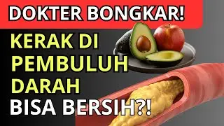 KERAK di Pembuluh Darah‼️Makanan INI Bisa MERONTOKKANNYA!!