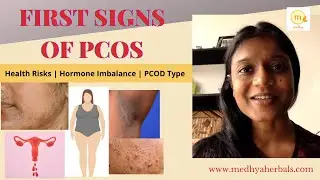 PCOD | PCOS Symptoms | First Signs of Polycystic Ovarian Syndrome