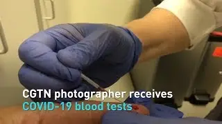 How to receive COVID-19 blood tests in U.S.