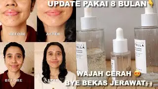 WAJAH CERAH NO BEKAS JERAWAT|SKIN1004 BRIGHTENING AMPOULE+WATERFIT SUN SERUM REVIEW |Maria Soelisty