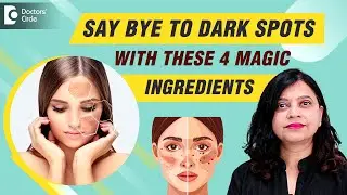 Pigmentation | Say Bye to DARK SPOTS on Face with 4 Magic Ingredients #skincare - Dr. Amee Daxini