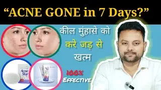 &ldquo;Acnestar Soap + Cream &mdash; 15 Din Me Acne Clean! Real Dermat Formula 🔥