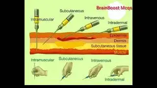 Injection Techniques Explained: IM, SC,IV & ID | WHO,ICN, ANA, NMC & International Medical Councils