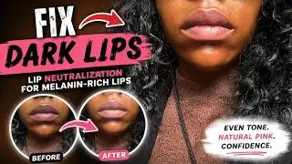 Fixing Hyperpigmentation on The Lips Using Lip Neutralization / Lip Tint/ Correction for Dark Lips