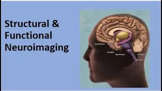 History of Neuroimaging/ Structural and Functional Neuroimaging