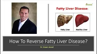 How To Reverse Fatty Liver Naturally