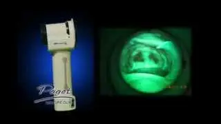 Velscope VX Oral Cancer Screening Exam