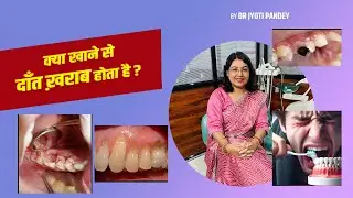 What food spoils your teeth?