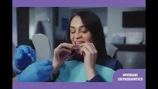 How Clear Aligners Actually Work: The Science of Your Smile