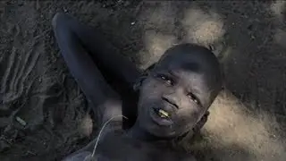 No cure yet for mystery Ugandan 'nodding disease'