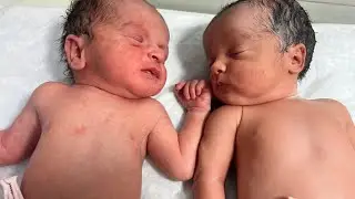 Cutest Twin Babies in NICU | Tiny Fighters With Big Hearts