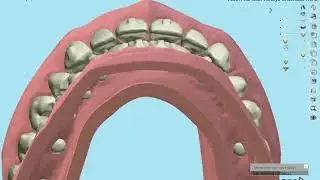 DentX Center: Innovation in Digital Dentistry