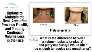 How Long Facelift Surgery Lasts, and Options for Neck Lifts and Facial Fat Transfer