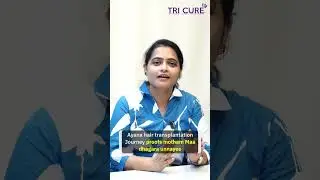 No fake - All real 💯 #tricure # experienced Surgeon # advanced FUE method
