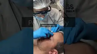 Men&rsquo;s Electrolysis Hair Removal by Furless Permanent | Dubai, Abu Dhabi & Riyadh | Free Consultation