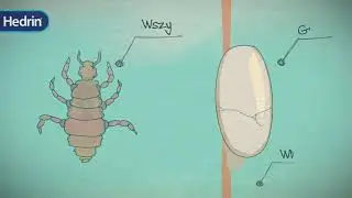Jak wykryć wszawicę - Hedrin