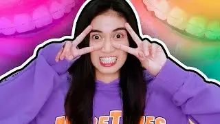 nag braces ulit ako