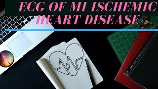 Myocardial infarction ECG | ISAAT VOL-4