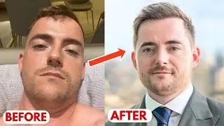I Quit Alcohol And MY LIFE CHANGED FOREVER