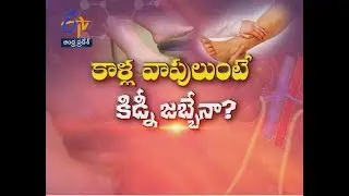 Leg Edema and Kidney Disease | Sukhibhava | 8th June 2018 | ETV Andhra Pradesh