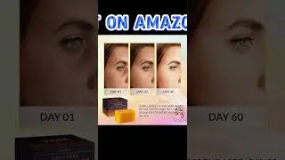 VALITIC Kojic Acid Dark Spot Remover Soap Bars with Vitamin C #amazondeals #amazonbeauty #amazonusa